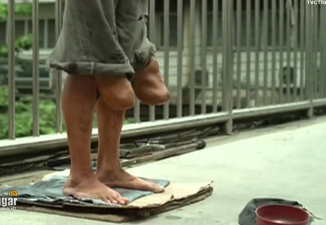 Video: Người đẹp cao tay bóc mẽ chiêu ăn xin lừa đảo Người ăn xin cụt chân lộ nguyên hình