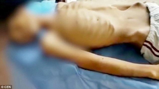 Tù nhân Venezuela khốn khổ vì đói khát Một tù nhân được cho là đã chết vì đói và bệnh tật tại nhà tù ở miền trung Venezuela - Ảnh cắt từ video clip.