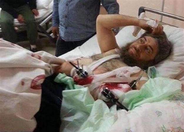 Thổ Nhĩ Kỳ chạy chữa cho các chiến binh IS bị thương từ Syria Chỉ huy chiến trường IS có tên là Abu Muhammad, 16.04.2014, đang điều trị miễn phí tại Bệnh viện nhà nước bang Hatay sau khi bị thương trong chiến trận ở Idlib, Syria. Có vẻ được chăm sóc khá chu đáo.