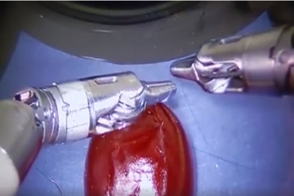 Video: Robot siêu công nghệ Da Vinci khâu được cả vỏ quả nho Video: Robot siêu công nghệ Da Vinci khâu được cả vỏ quả nho