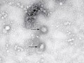 Hình ảnh virus corona chủng mới dưới ống kính hiển vi (Ảnh: Đông Phương)