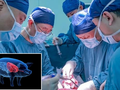 Nhóm khoa học Đại học Y khoa An Huy đã thực hiện thành công ca ghép gan lợn đã chỉnh sửa gene cho bệnh nhân ung thư (Ảnh: Guangming)