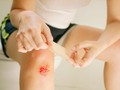 Một vết rách có thể không đơn giản như bạn tưởng. Nguồn: DB