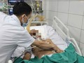 Nhiễm giun lươn, người đàn ông ở Hà Nội nguy kịch