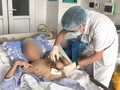 Người quản trang suýt chết vì một loại nấm đen hiếm gặp