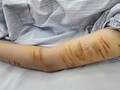 Người trẻ rủ nhau tự gây thương tích, bác sĩ chỉ ra nguyên nhân kèm lời khuyên