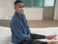 Phát hiện ca bệnh hiếm “bụng quả mận khô” ở người 40 tuổi