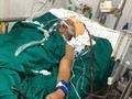 Dập nát ngực, phổi do rơi từ tầng 4, thợ xây vượt cửa tử sau 5 ngày đặt ECMO