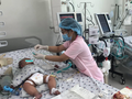 Sốt xuất huyết dễ trở nặng hơn khi từng nhiễm COVID-19