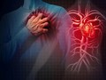 Sử dụng NSAID có liên quan đến tăng nguy cơ nhập viện vì suy tim lần đầu với bệnh nhân bệnh tiểu đường loại 2. Ảnh ScitechDaily.