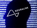 Liên doanh y tế Neuralink. Ảnh CNBC