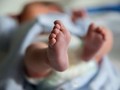 Kkhông có sự khác biệt về độ chính xác khi phát hiện chứng tràn khí màng phổi bằng ảnh chụp trên điện thoại thông minh và phim chụp X-quang gốc. (Nguồn: abc.net.au)