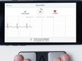 Ảnh: INTERMOUNTAIN MEDICAL CENTRE HEART INSTITUTE / DPA