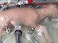 Nuôi dưỡng cừu non trong tử cung nhân tạo