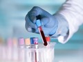 Nhóm máu khác nhau có tỷ lệ nhiễm virus khác nhau (ảnh: SCMP)
