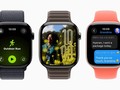 watchOS 26 trên Apple Watch. Ảnh: Apple