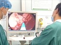 Người đàn ông bị xuất huyết tiêu hóa nguy kịch, bác sĩ chỉ ra nguyên nhân phổ biến