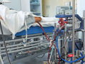Kỹ thuật ECMO điều trị bệnh nhân 91, phi công người Anh tại BV Bệnh Nhiệt đới (Ảnh: SYT)