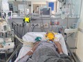 Bệnh nhân Đỗ Văn Ch. (46 tuổi, ở Tĩnh Gia, Thanh Hóa) nhập viện vào BV Bạch Mai trong tình trạng đã ngừng tim, hiện vẫn hôn mê sâu (Ảnh: BVCC) 