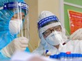 Xét nghiệm SARS-CoV-2 khẳng định COVID-19 bằng phương pháp Realtime RT-PCR - Ảnh: BYT