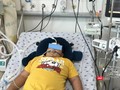 Một bệnh nhi bị hội chứng viêm đa hệ thống sau mắc Covid-19 (Ảnh- BV Nhi đồng Thành phố)
