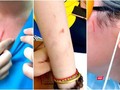 Nữ sinh bị nhiều vết thương sau vụ ẩu đả. Ảnh cắt từ clip được livestream