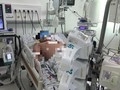 Bệnh nhân sốc sốt xuất huyết nặng điều trị tại Bệnh viện Nhi đồng Thành phố (TP HCM). Ảnh: BVCC