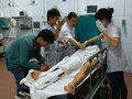 Cấp cứu cho bệnh nhân tai nạn giao thông tại Bệnh viện Hữu nghị Việt Đức