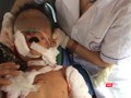 Một trường hợp trẻ em bị thương nặng do chó nhà tấn công