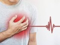 Người mắc bệnh suy tim (ảnh minh họa)