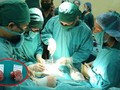 Các bác sĩ phẫu thuật loại bỏ 2 khối u hình giống chiếc xúp lơ có trọng lượng 1,6 kg và 2 kg của các bệnh nhân T. và V.