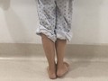 Sau lần phẫu thuật cách đây 4 năm, nữ sinh Đỗ Thị Kim C. phải chịu đôi chân lệch nhau 2 cm, dáng đi tập tễnh khiến em tự ti.