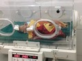 Cháu bé sinh non khi được khoảng 8 tháng và mới chỉ nặng 1,6kg.