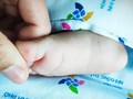 Trẻ từ 15 tuổi trở xuống chiếm phần lớn trong số các tử vong do sốt xuất huyết.
