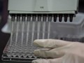 Bộ trưởng Y tế Đức đã gạt phăng ý tưởng Mỹ độc quyền vaccine ngừa COVID-19 do Đức sản xuất (Ảnh: Guardian)