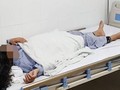 Bé gái 13 tuổi đang được điều trị tại Bệnh viện Da liễu Trung ương.