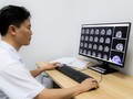TS.BS. Nguyễn Đức Liên -Trưởng khoa Ngoại thần kinh, Bệnh viện K.