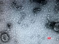 Virus SARS-CoV-2 được nuôi cấy và phân lập thành công tại Viện Vệ sinh dịch tễ Trung ương. Ảnh: Minh Thúy