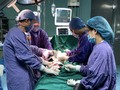 Kíp mổ cho bệnh nhi bị gãy xương đùi. Ảnh: Bệnh viện Hữu Nghị