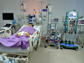 Các bác sĩ ở Bệnh viện Đa khoa tỉnh Sóc Trăng sử dụng ECMO để cứu sống bệnh nhân H. (Ảnh - BVCC)