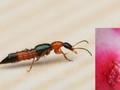 Vết phỏng da do kiến ba khoang cắn