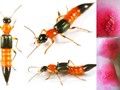 Những vết cắn của kiến ba khoang gây ra tổn thương nghiêm trọng cho da