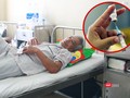 Nghiên cứu vắc-xin sốt xuất huyết tại Việt Nam đã hoàn tất