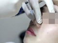 Thêm 1 tai nạn thẩm mỹ nghiêm trọng trên địa bàn TP.HCM