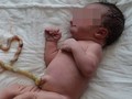 Một em bé bị tử vong nghi do mẹ sinh thuận tự nhiên. Ảnh minh họa