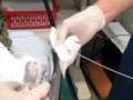 Một phần con sán dây bò được lấy ra khỏi tá tràng của bệnh nhân. Ảnh: BVCC