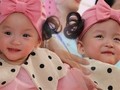 Song nhi cười thật tươi trong ngày xuất viện. Ảnh: Pháp luật & Bạn đọc