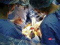 Ê kíp bác sĩ Bệnh viện Đà Nẵng đang thực hiện ca ghép thận cho bệnh nhân