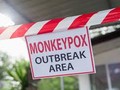 WHO tuyên bố đợt bùng phát dịch đậu mùa khỉ là tình trạng khẩn cấp y tế toàn cầu (Ảnh: SciTechDaily)