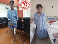 Nữ sinh U. đứng, tập đi lại sau khi được phẫu thuật.